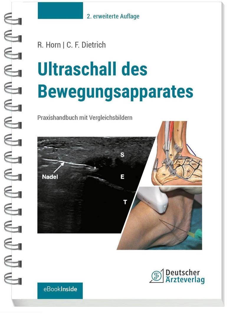 Ultraschall des Bewegungsapparates
